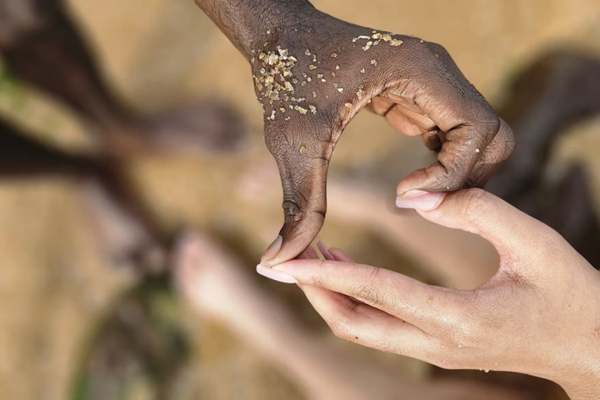 Benefits of Sustainable Charity